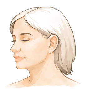 facelift postop facelift postop